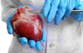 فیزیوتراپی بعد از جراحی قلب چه ضرورتی دارد؟